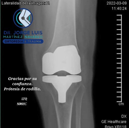 Jorge Luis Martínez Navarro-8