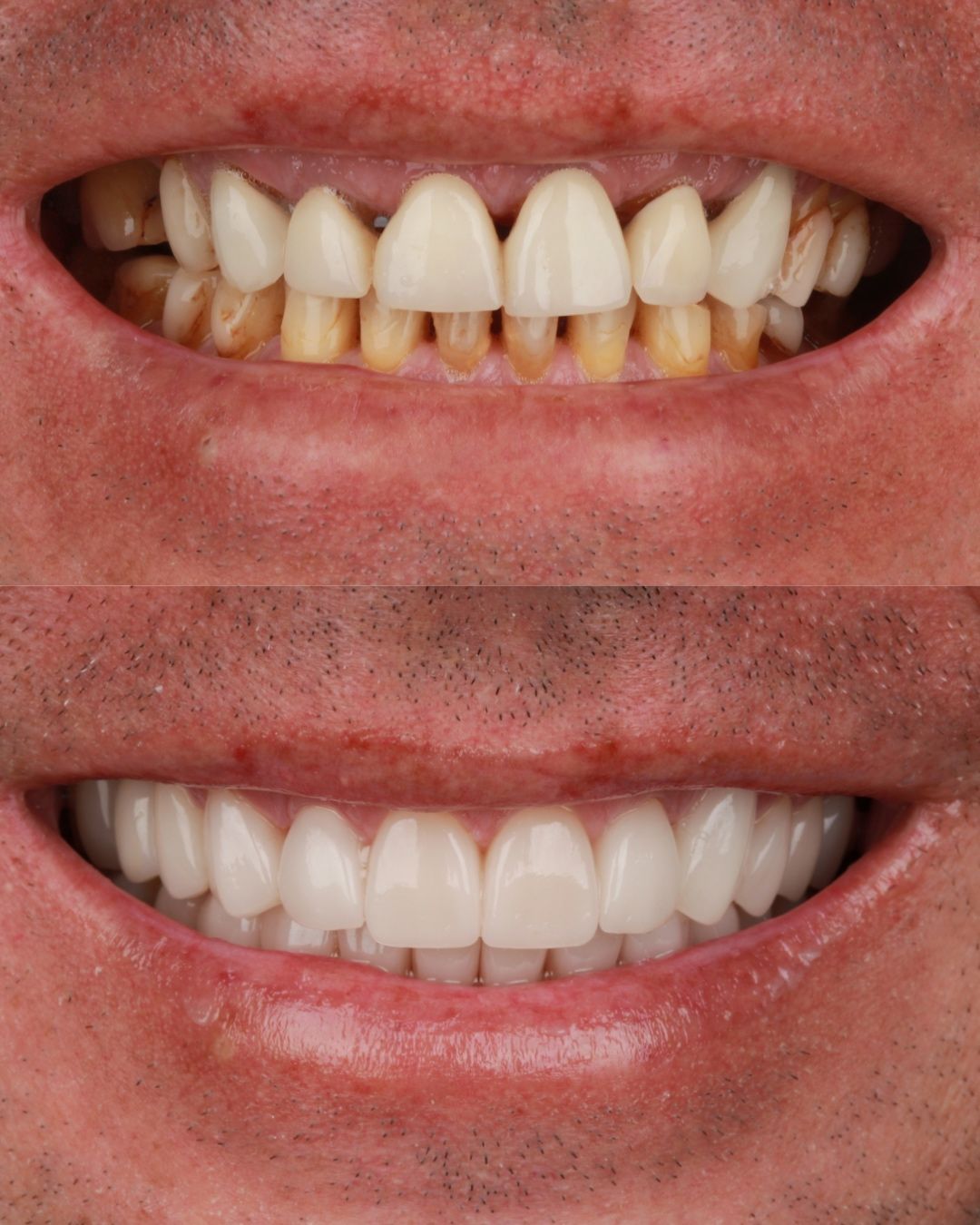 Diana Chacon Cervera-1