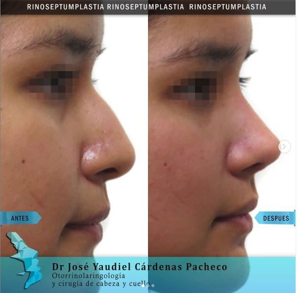 José Yaudiel Cárdenas Pacheco-8