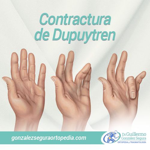 Guillermo González Segura-8