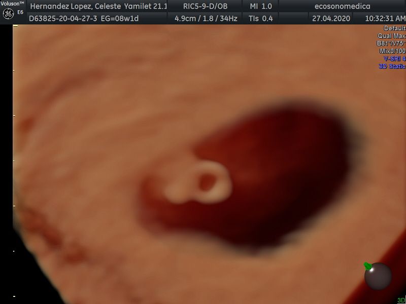 Héctor Bernardo Acevedo Manrique-11