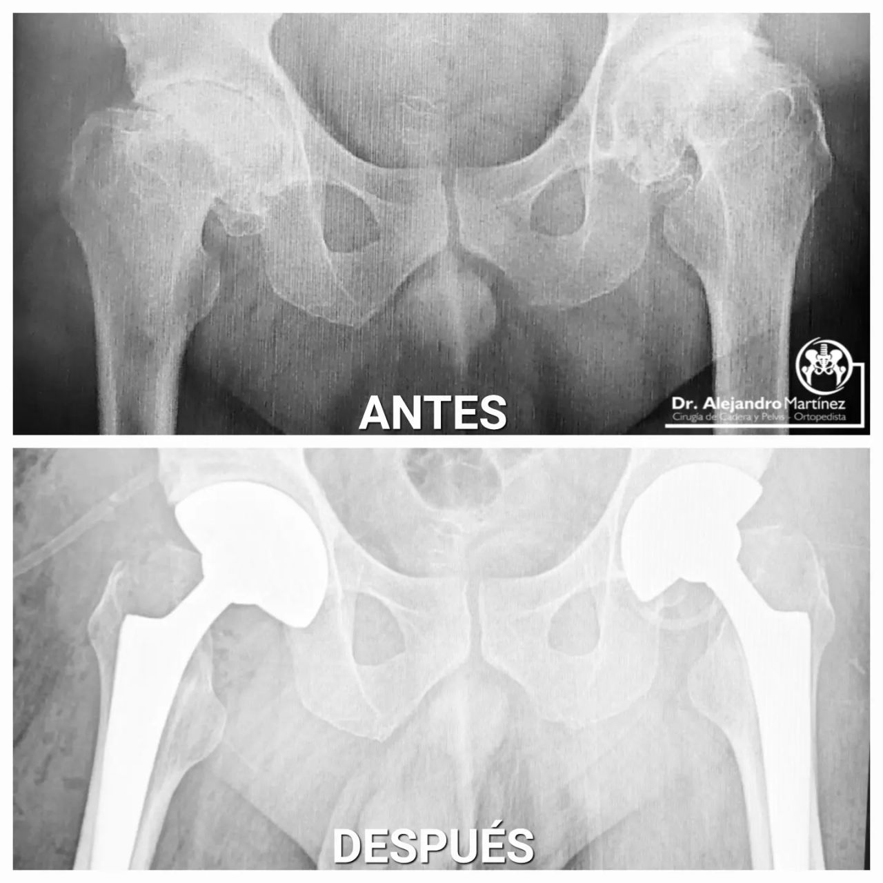 Alejandro Martínez Ramírez-10