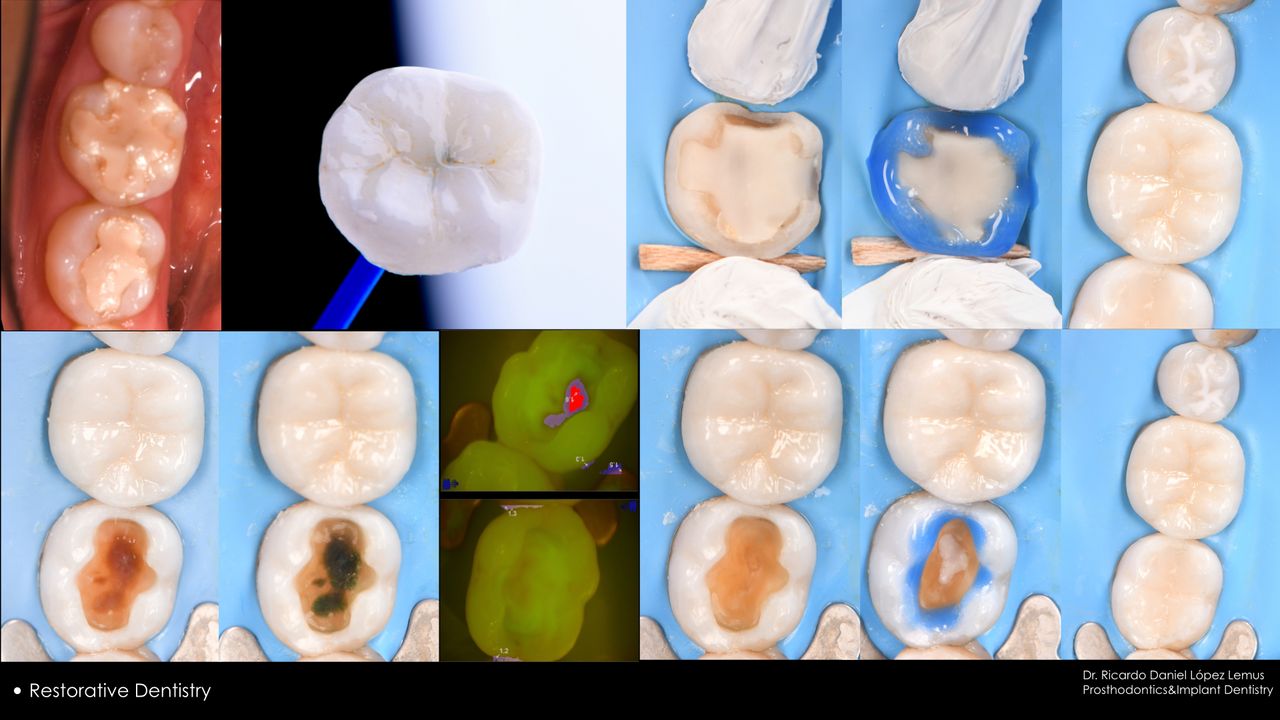 Ricardo López Lemus-34