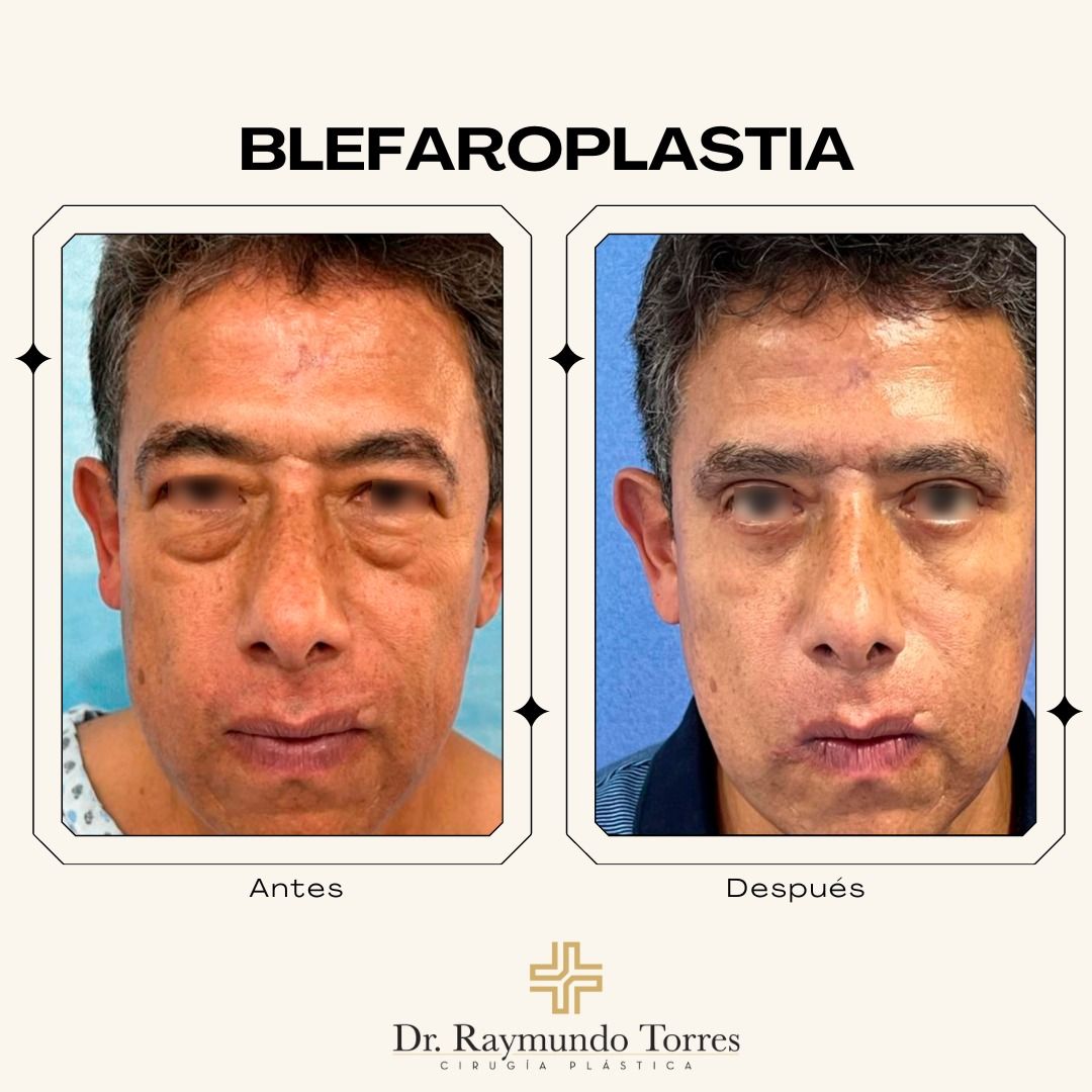 Raymundo Torres Piña-15