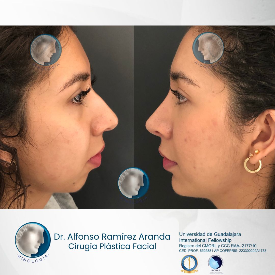 Alfonso Ramírez Aranda-41