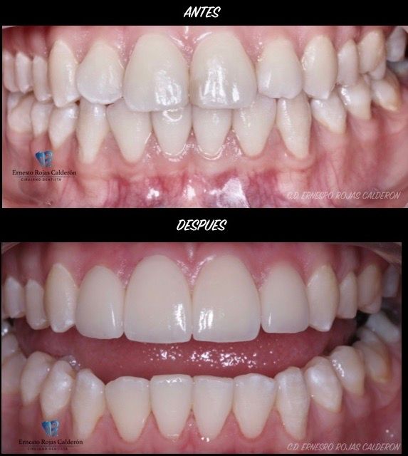 Ernesto Rojas Calderon-40