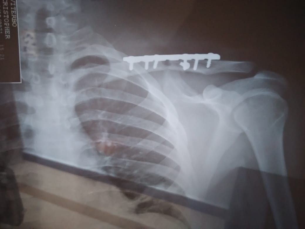 Jeftte Aaron Chacon Martinez-4