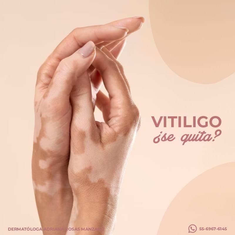 Adriana Rosas Manzano-6