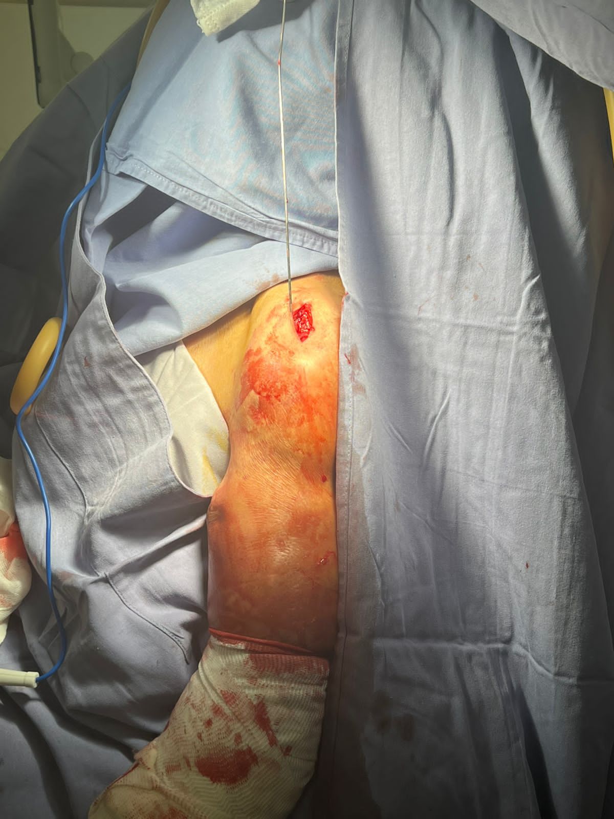 Oscar Alberto Pérez Peralta-23