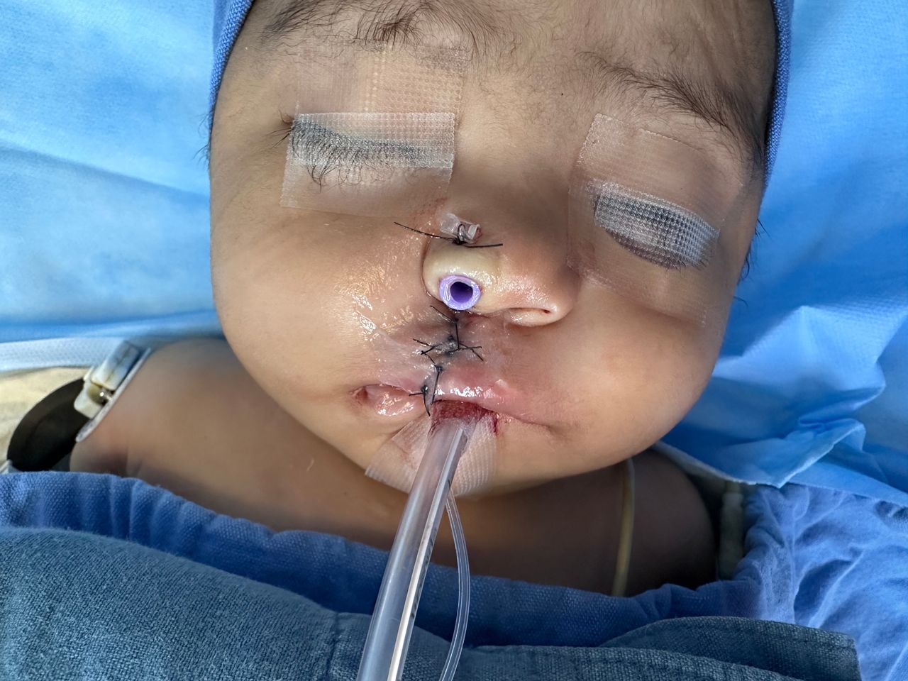 Erendalhi Rocha Mesta-4