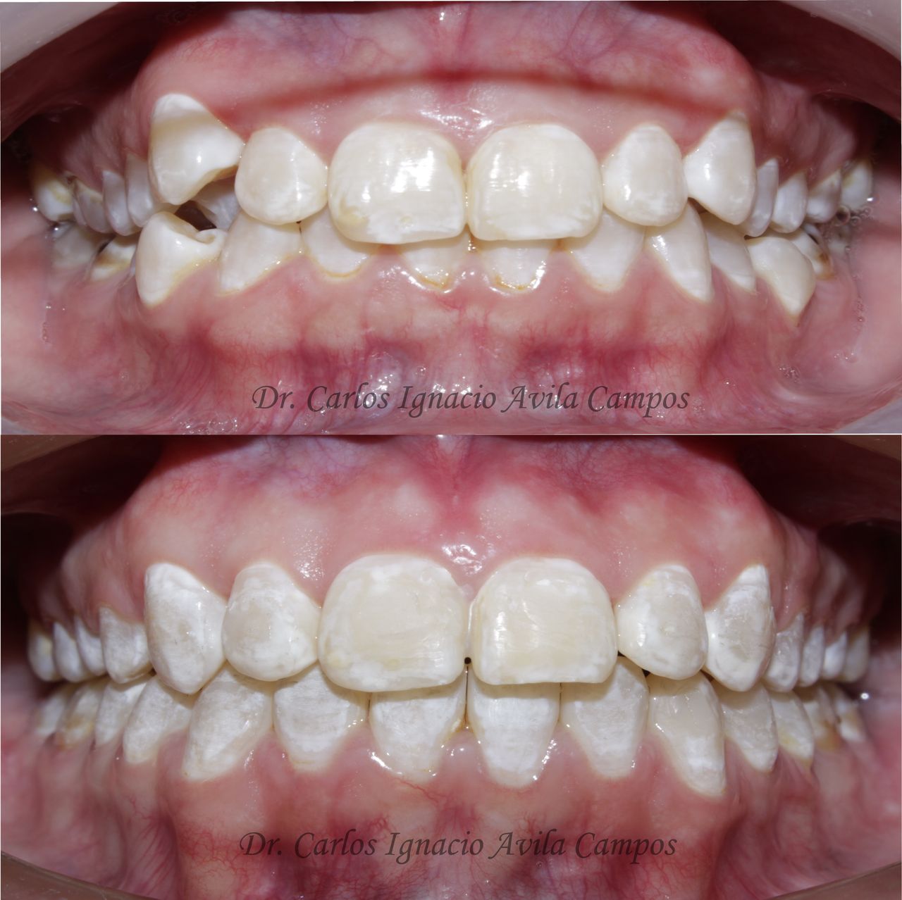 Carlos Ignacio Avila Campos-3