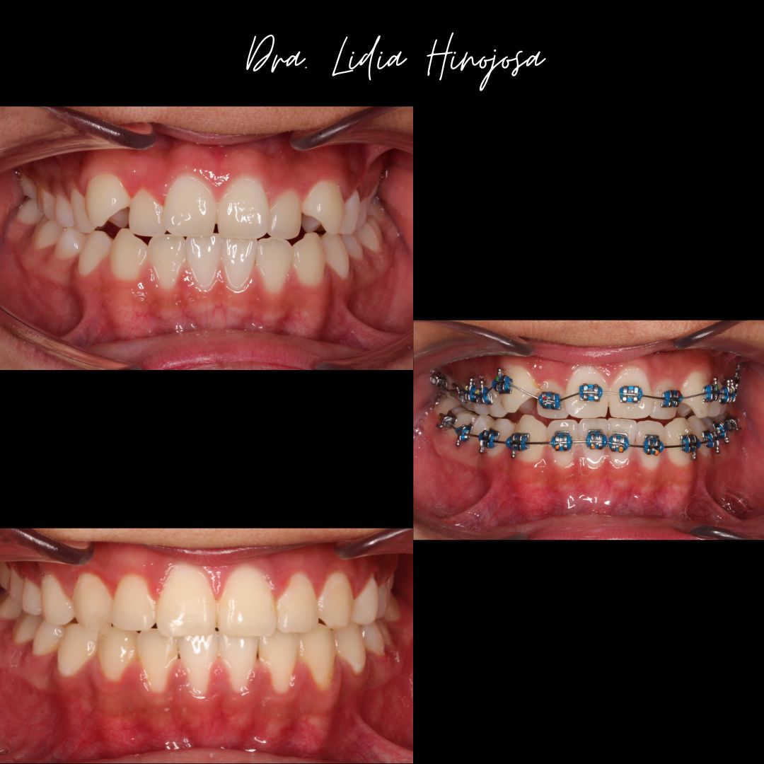 Lidia Abigail Hinojosa Arellanes-26