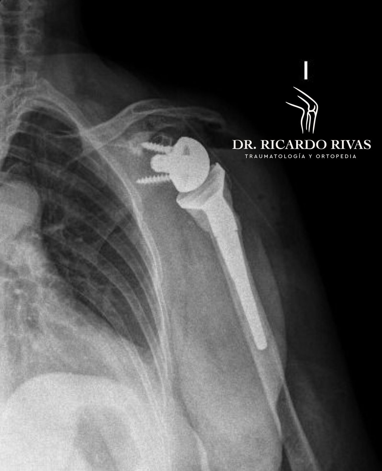 Ricardo Rivas Meléndez-12