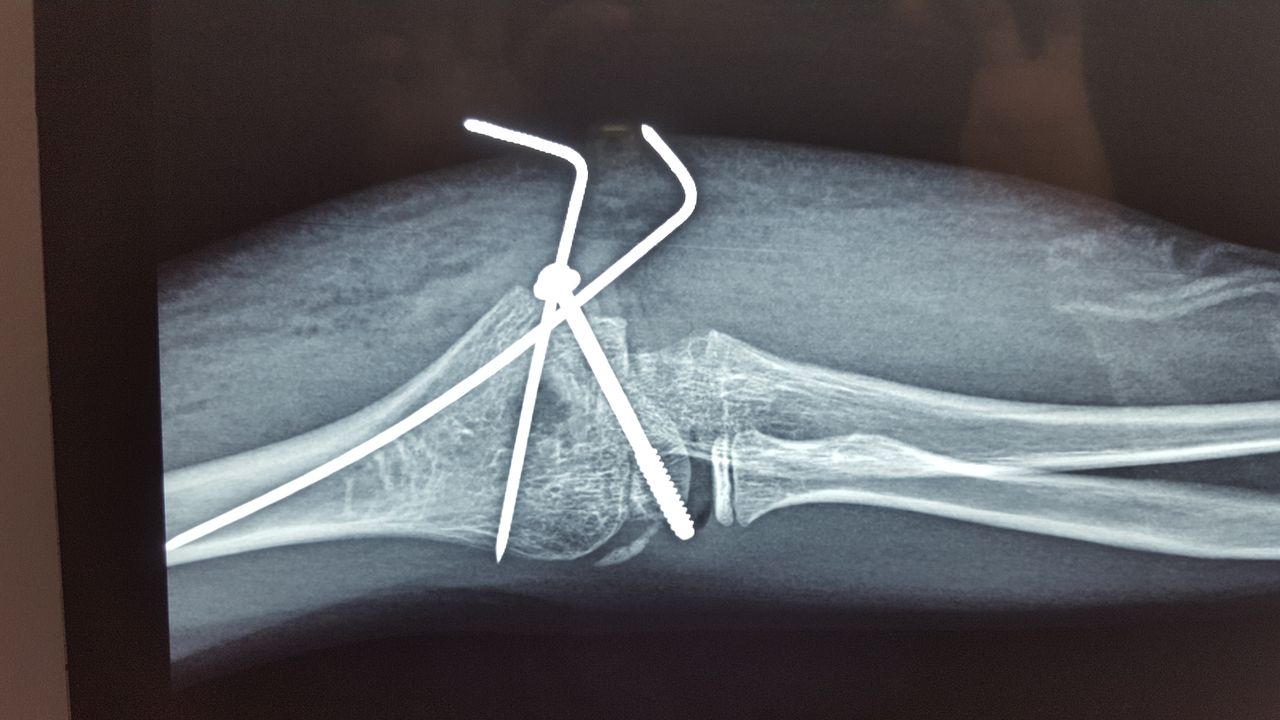 Alfonso Meza Vernis-60