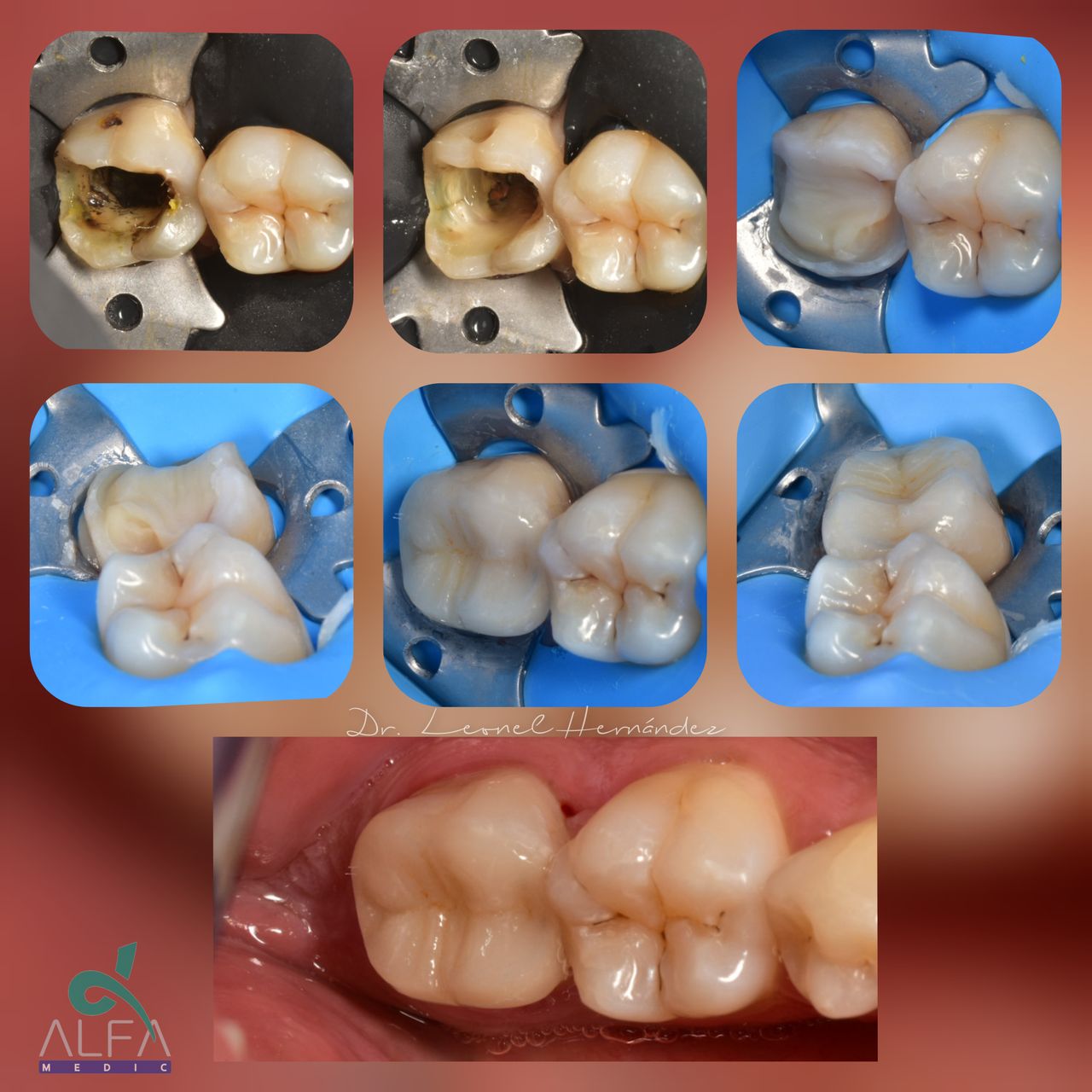 Leonel Hernández Gómez-21