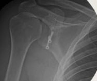 Pedro López Villalva-0