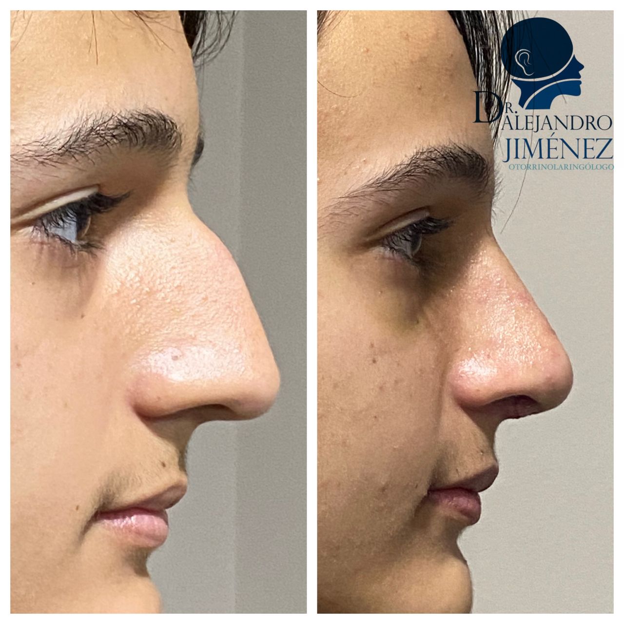 Alejandro Jimenez Garcia-27