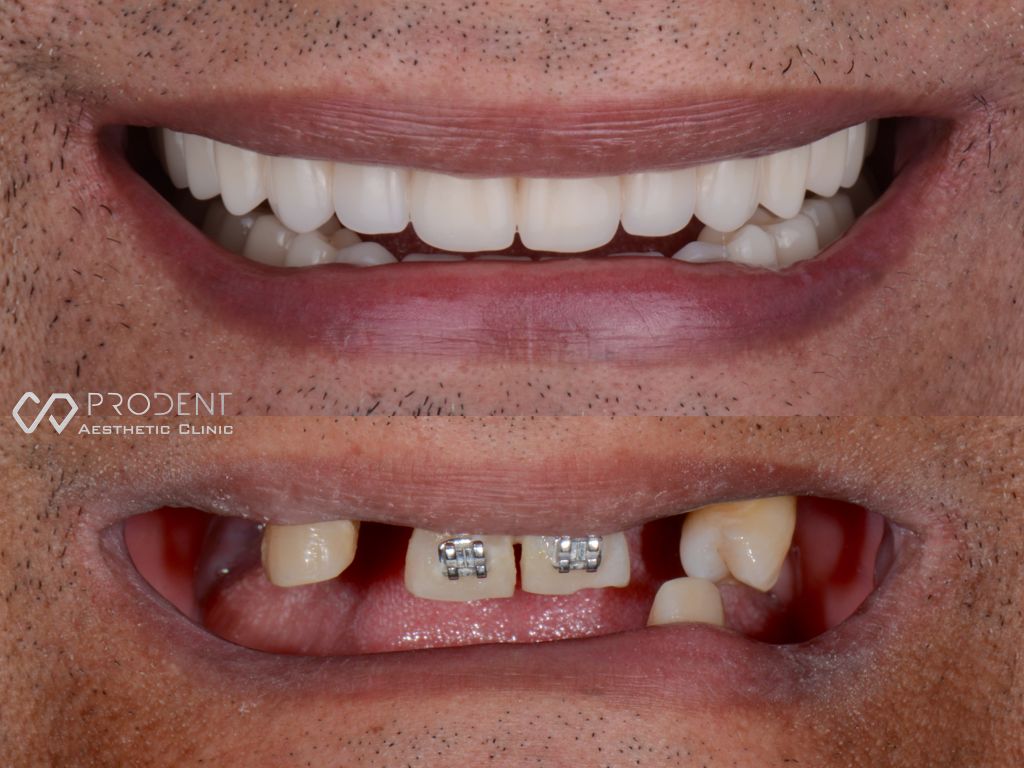 Ramiro Ivan Pérez Murillo-16