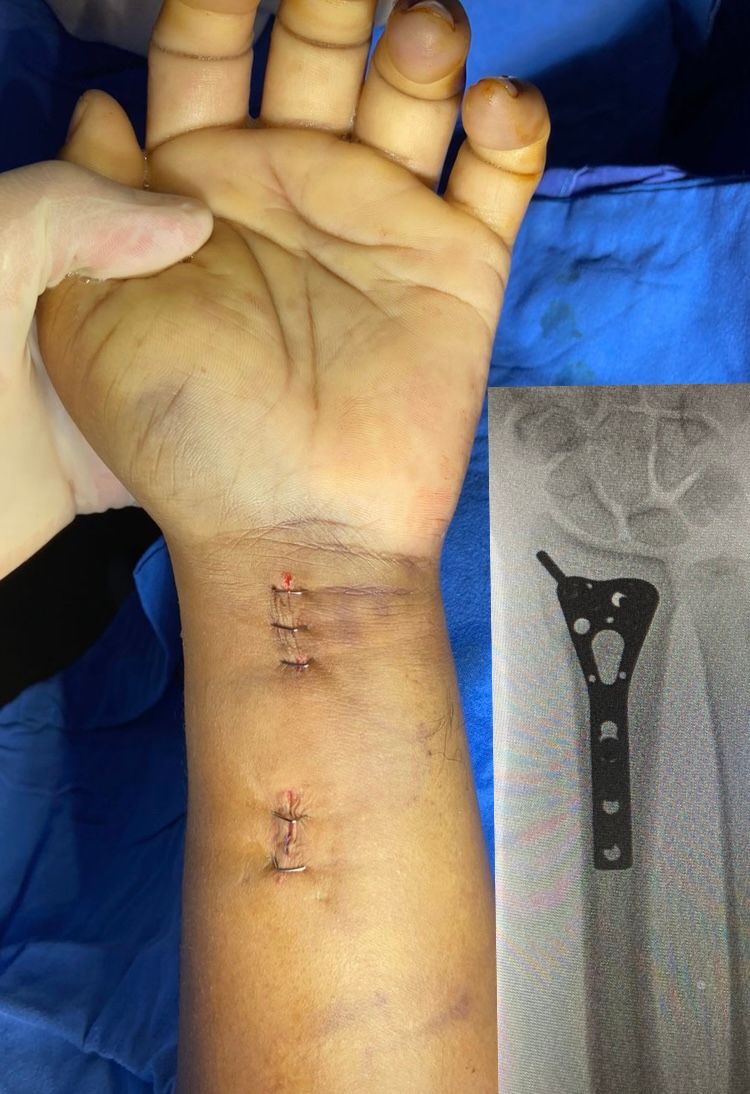 Miguel Angel Ruiz Resendiz-5