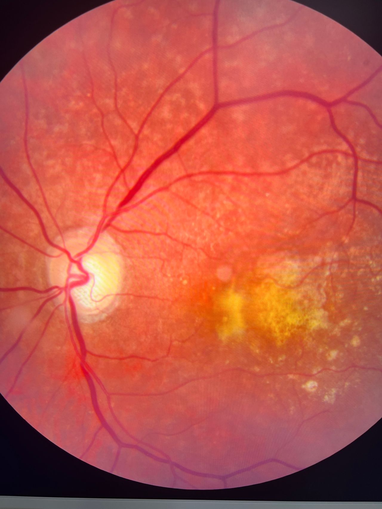 Javier Suárez Arguello-5