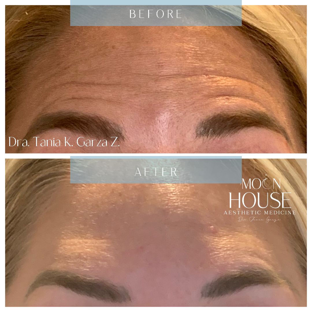 Tania Karine Garza Zepeda-16