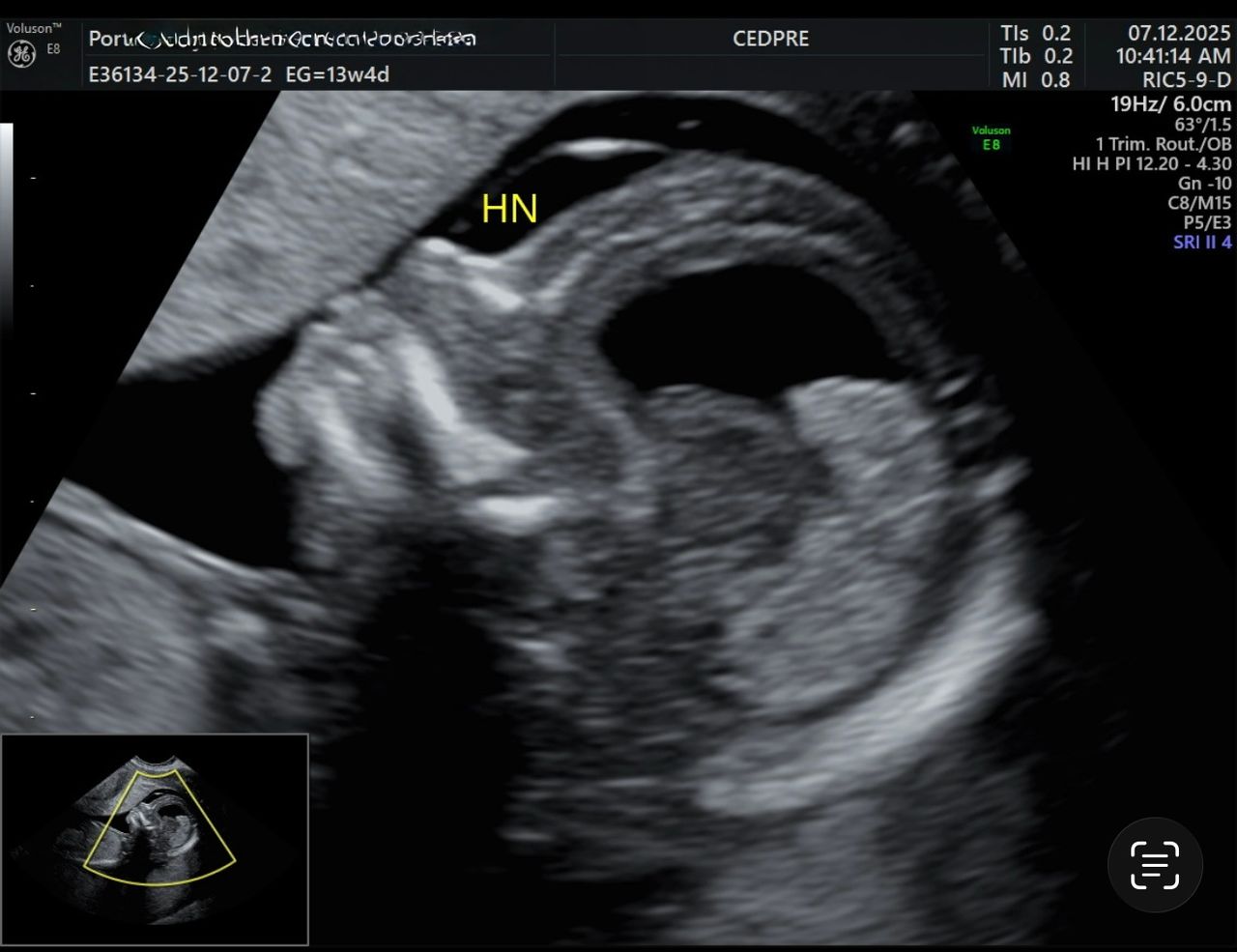 Jacquelin Montserrat Gadea Noriega-0