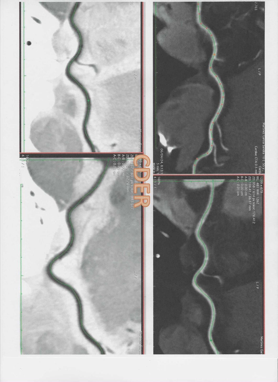 Luis Enrique Vera   Arroyo-6