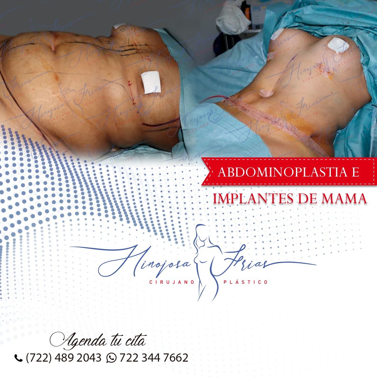 Miguel Ángel Hinojosa Frías-2