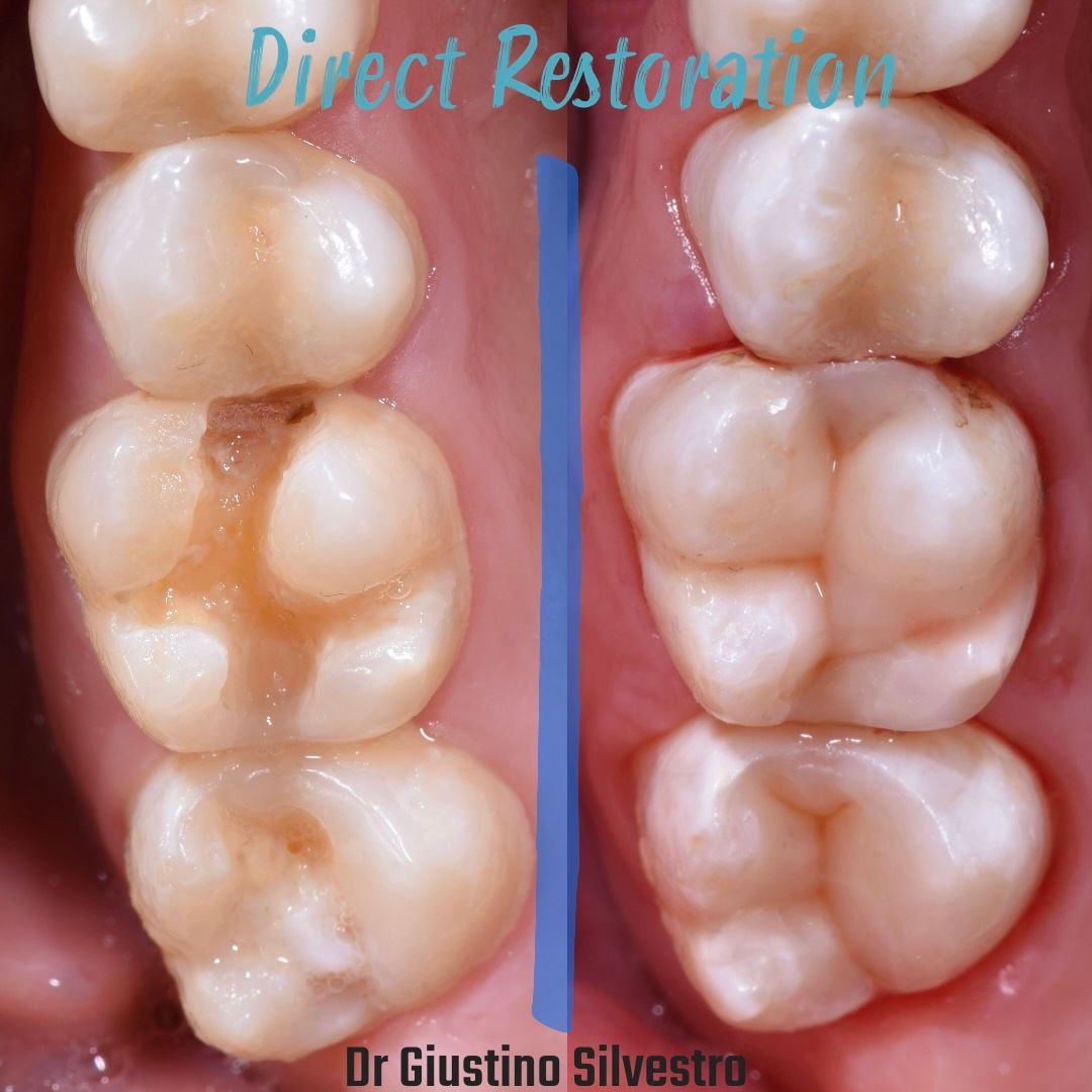 Giustino Silvestro-4