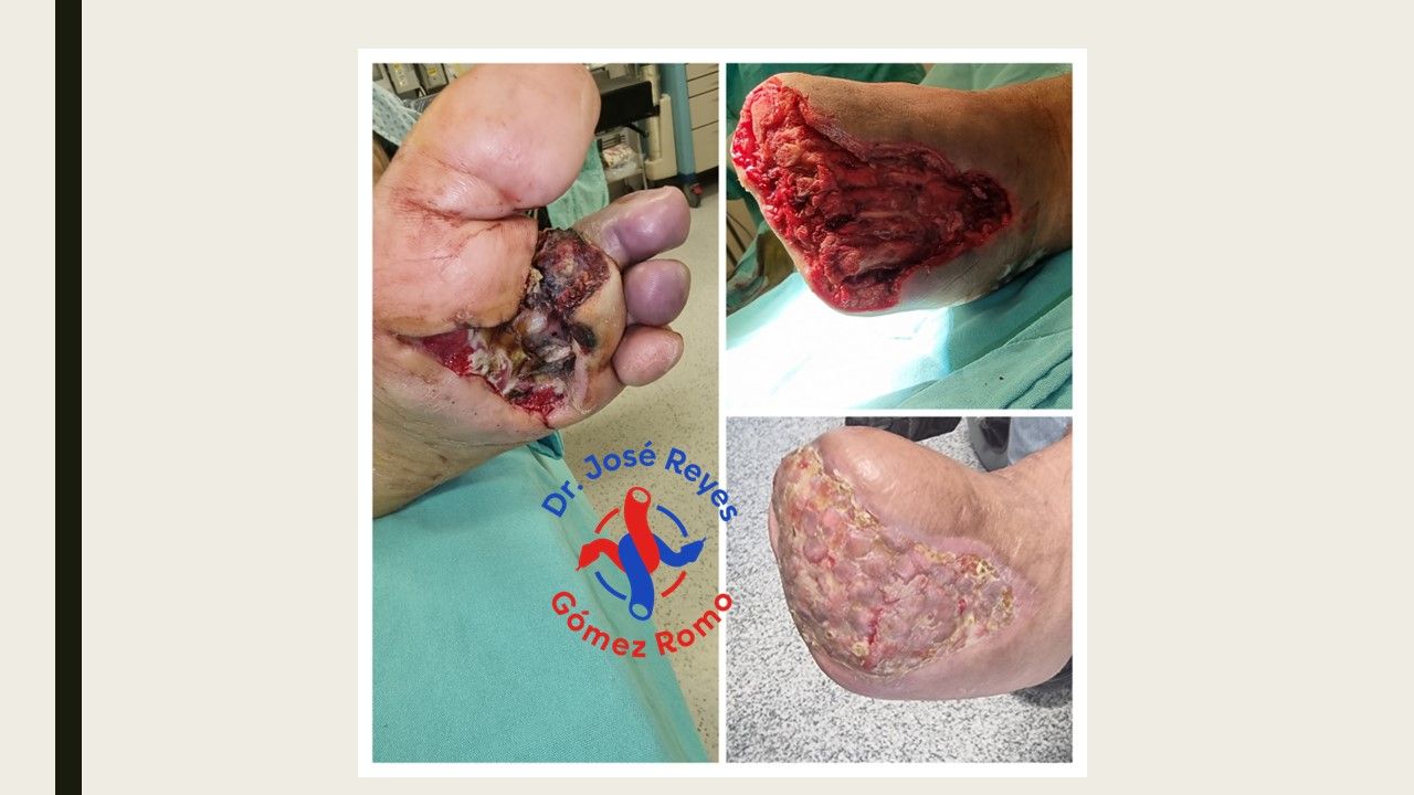 José Reyes Gómez Romo-2