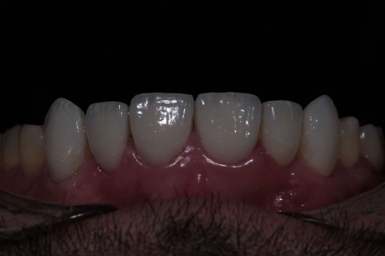 David Alan Escamilla Álvarez-5