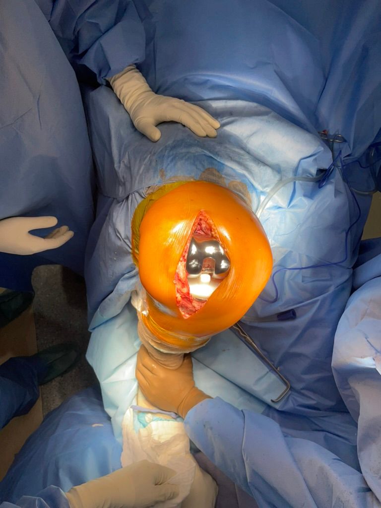 Jose De Jesus Perez Cisneros-3