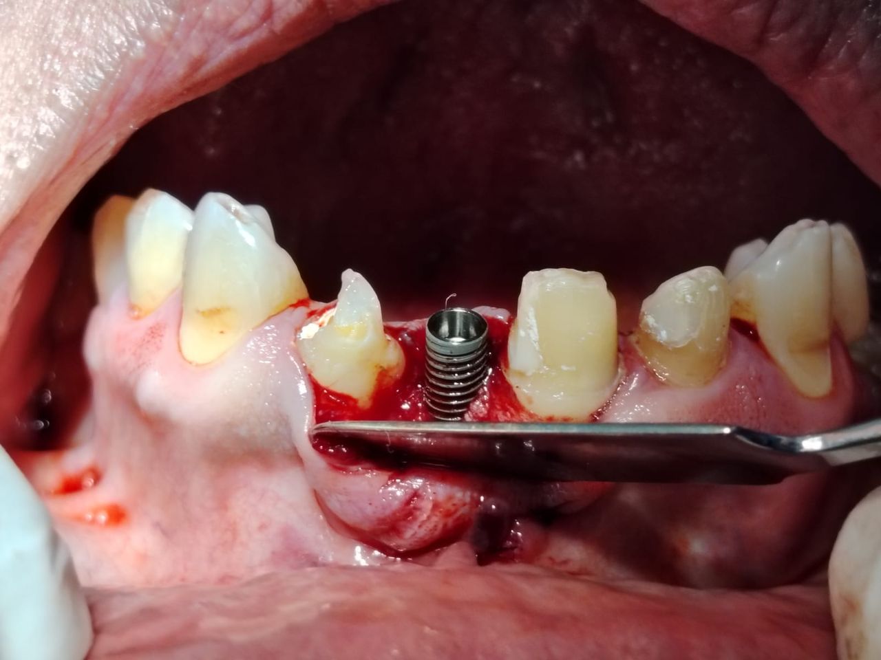 Mario Eduardo Sanchez Arellano-2