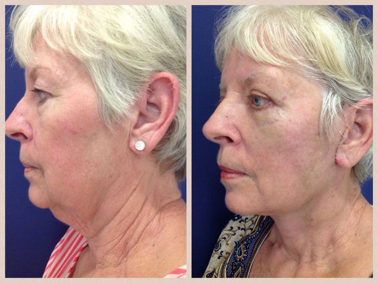 Antonio Rojas Macedo-8