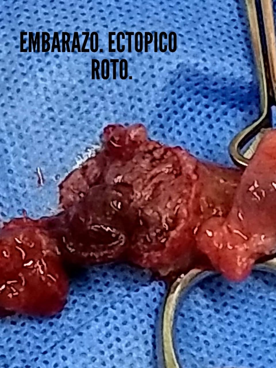 Ma. Del Carmen Hernández Ovando-4