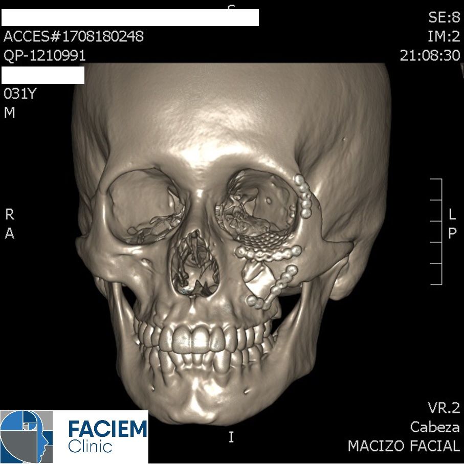 Arlen Colín Ordaz-46