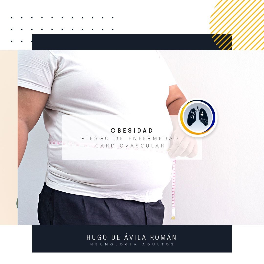 Hugo De Ávila Román-4