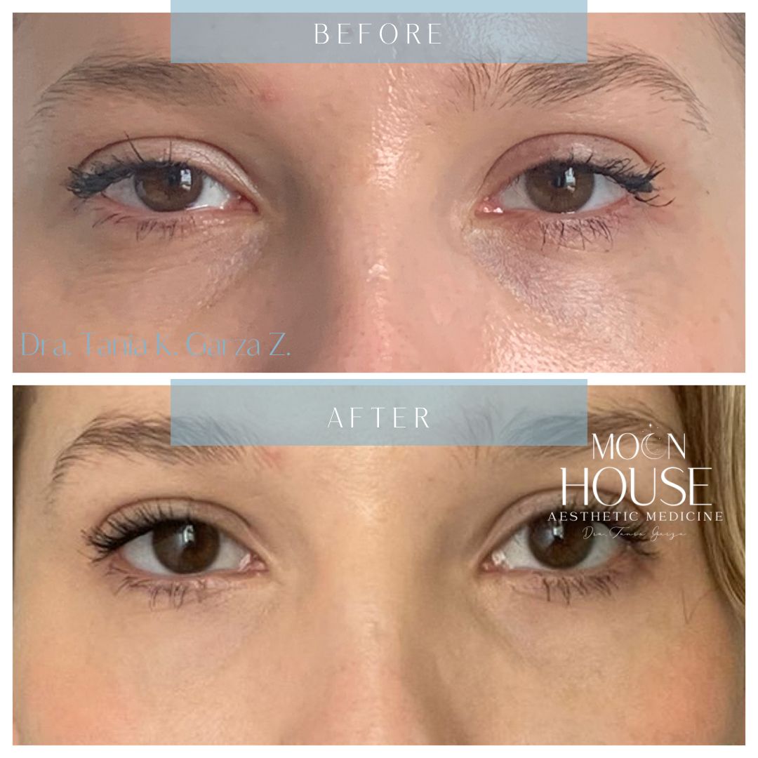 Tania Karine Garza Zepeda-7