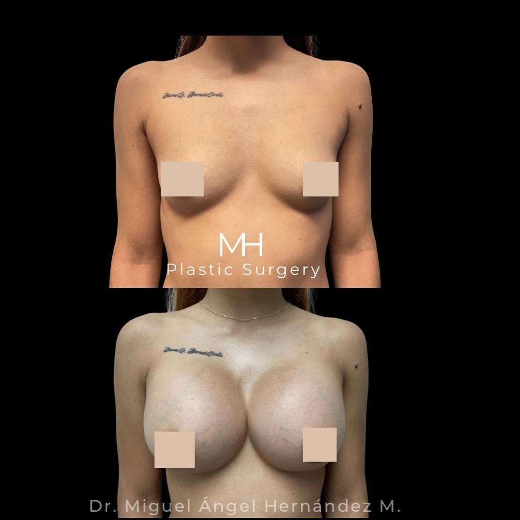 Miguel Angel Hernández Muñoz-2