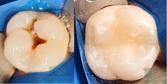 Ana Karen Basulto Cruz-4