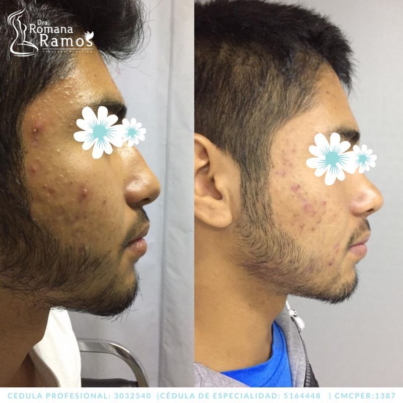 Romana Ramos Cárdenas-38