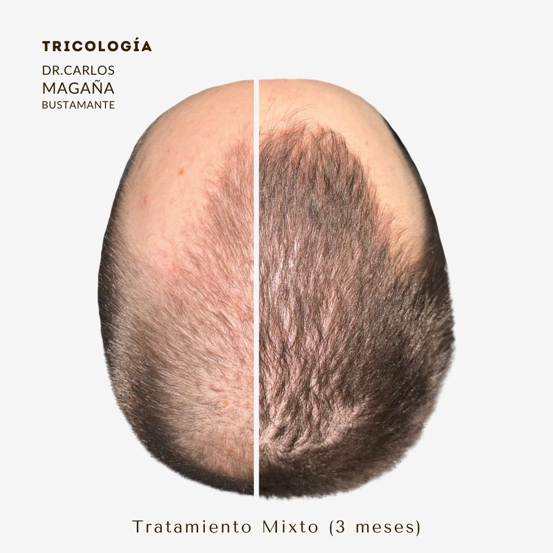 Carlos Alberto Magaña Bustamante-4