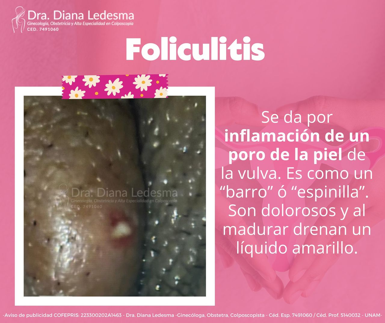 Diana Ledesma Estrada-35