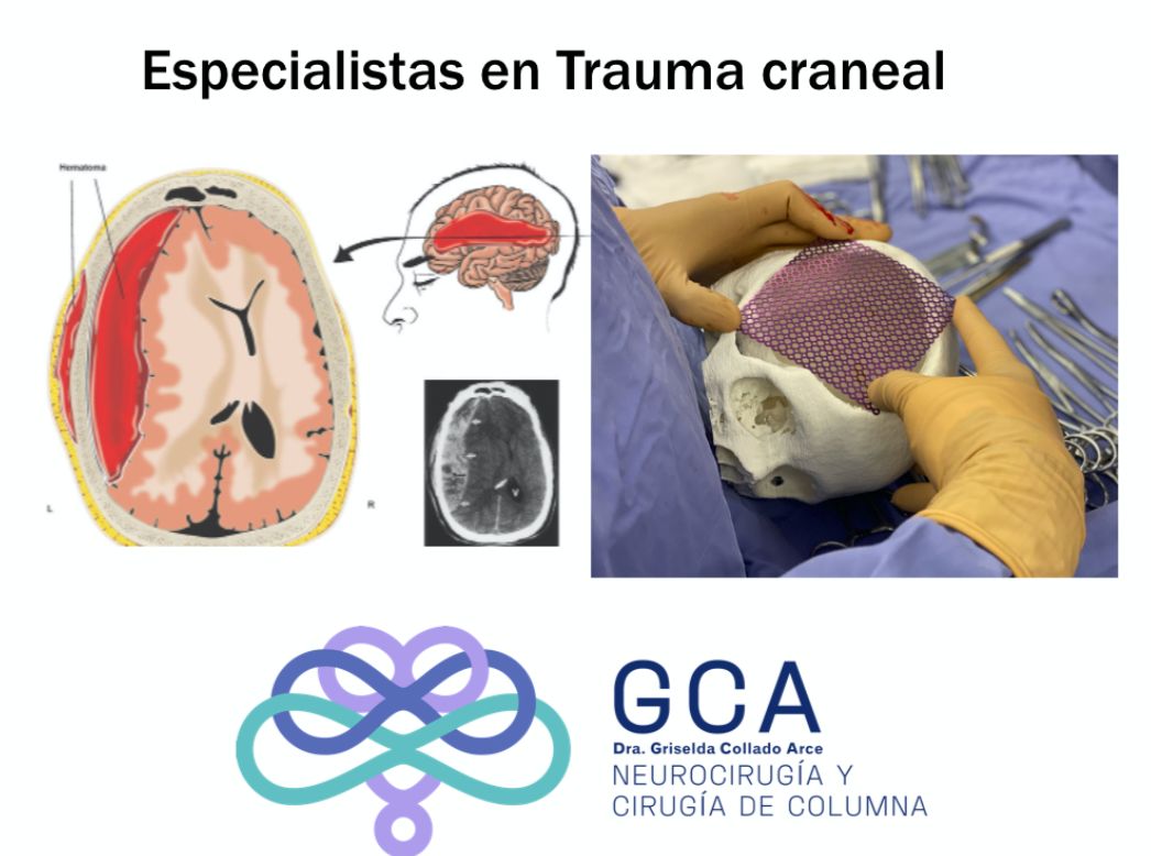 Griselda Collado Arce-11