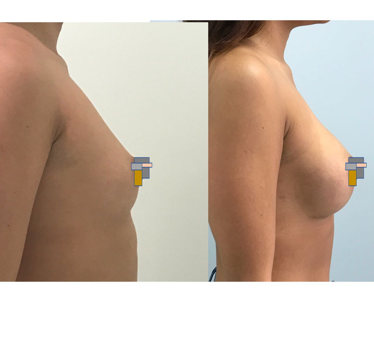 José Cortés Arreguin-13