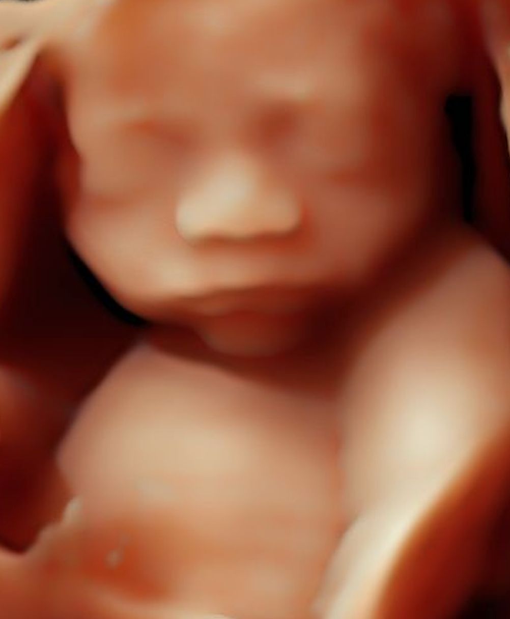 Dulce Anabel Jarquin Arango-50