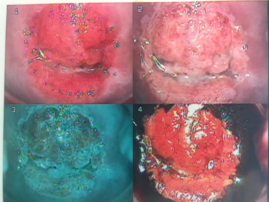 Alfredo Mendez Samano-20