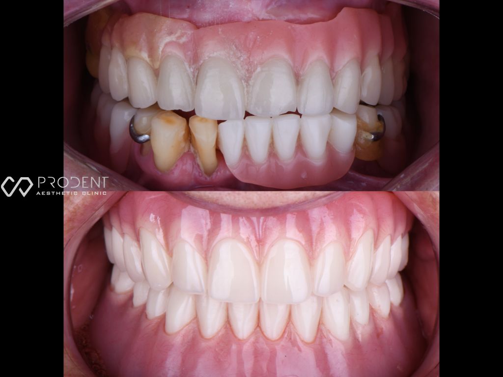 Ulises Pérez Murillo-75