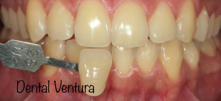 Antonio Cerda Ventura-23