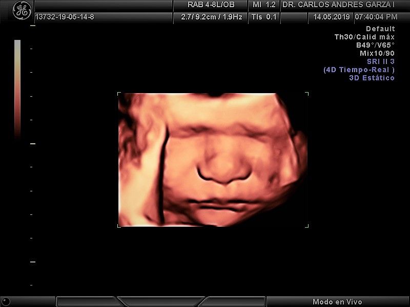 Carlos Andrés Garza Flores-5